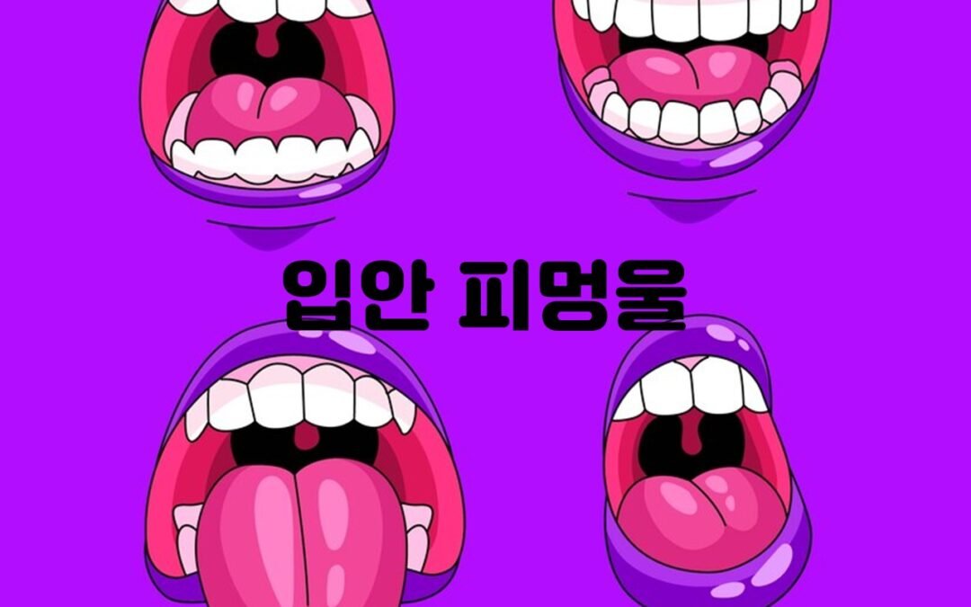 구내 혈종의 원인과 예방법